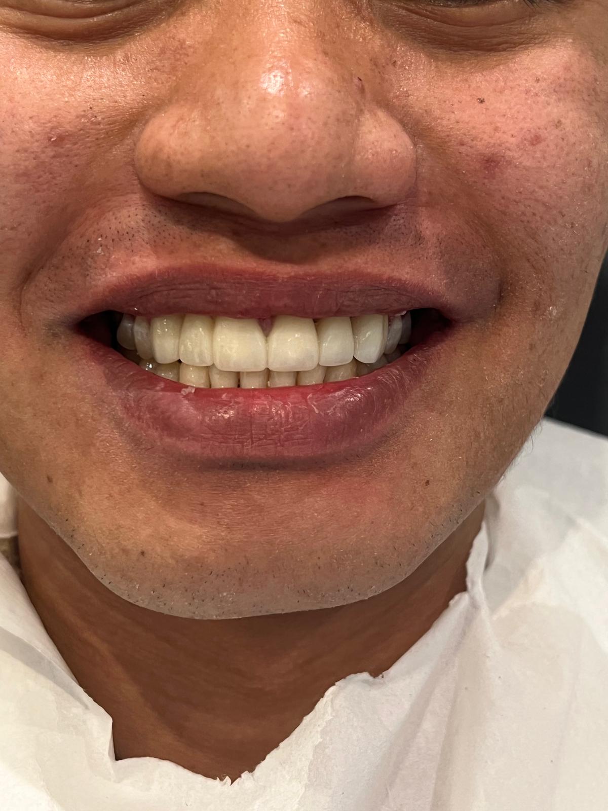 ECE Dental Patient Transformation
